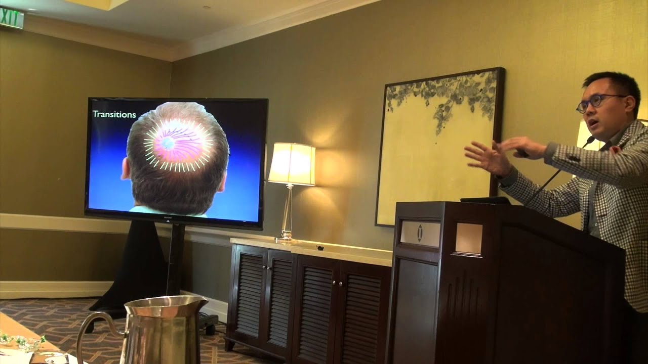 Hair Transplant for the Crown by Dr. Sam Lam