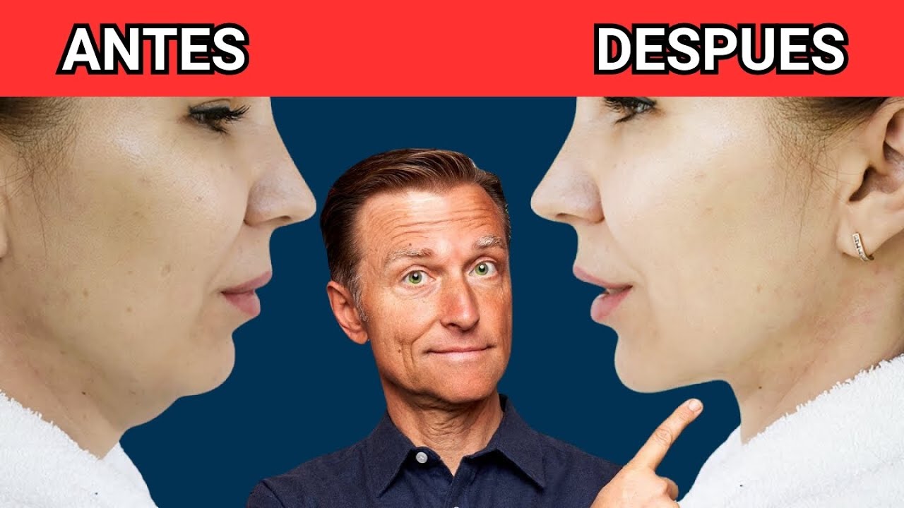 La forma m&aacute;s r&aacute;pida de deshacerse de la papada