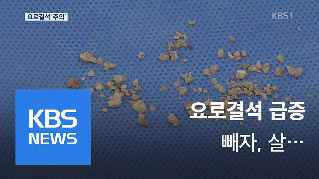 요로결석 급증&hellip;&ldquo;비만&middot;고혈압이 원인&rdquo; / KBS뉴스(News)
