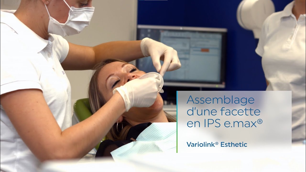 Variolink® Esthetic LC - Assemblage d´une facette en IPS e.max® | FR | Ivoclar