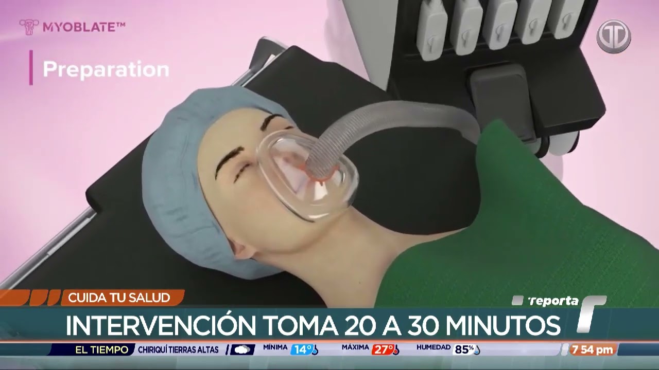 1RA CIRUGÍA DE ABLACIÓN DE MIOMAS POR RADIOFRECUENCIA