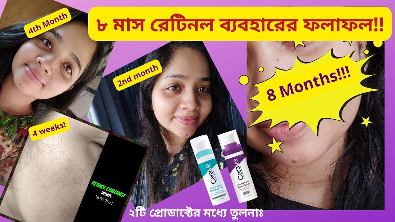 💊 রেটিনল সিরাম - আমার ৮ মাসের অভিজ্ঞতা । RETINOL Before and After