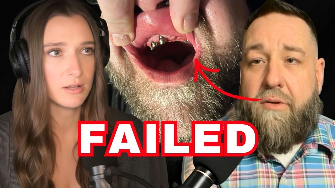 My Dental Implant Failed… Here's What Happened Next