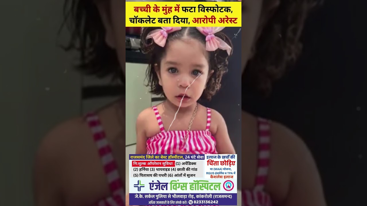 राजस्थान के अलवर में बच्ची के मुंह में फटा विस्फोटक, अस्पताल में सर्जरी #alwar