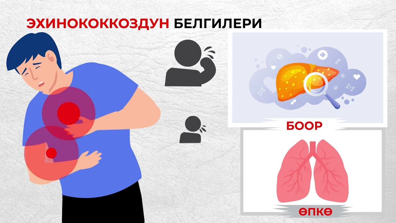 Эхинококкоз