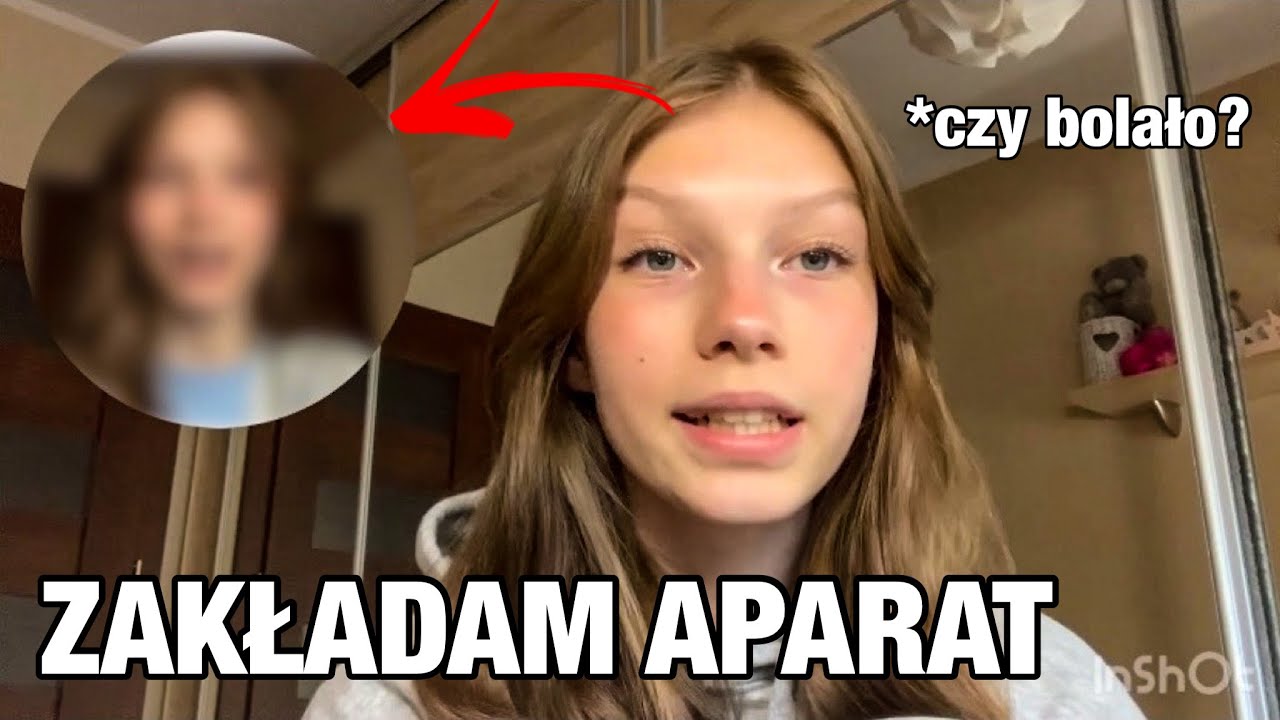 ZAKŁADAM APARAT ORTODONTYCZNY- jak to wygląda, pierwsze dni, jak dbać o zęby w aparacie?