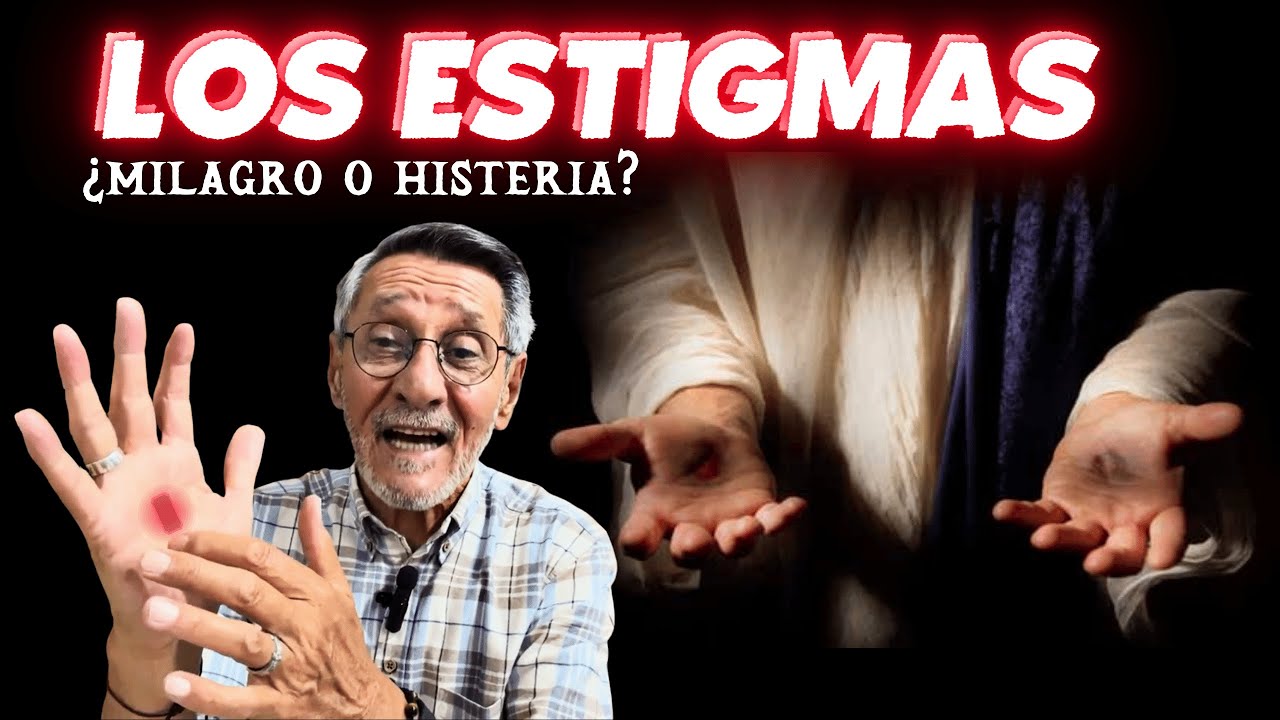 Los estigmas: &iquest;milagro o histeria?
