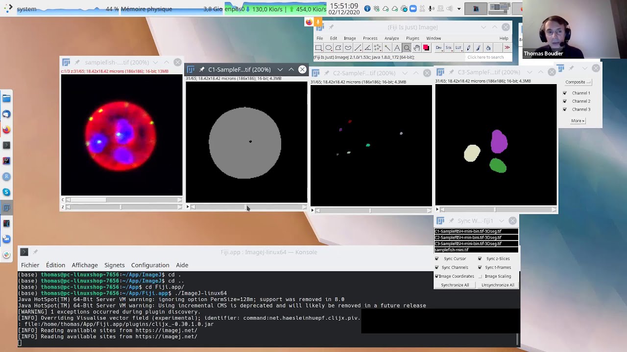 I2K 2020 tutorial: 3D Analysis with the 3D ImageJ Suite (session 2, part 1)