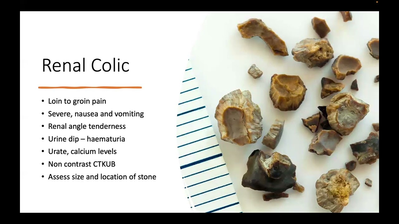 Urology - Common Conditions (Part 2)