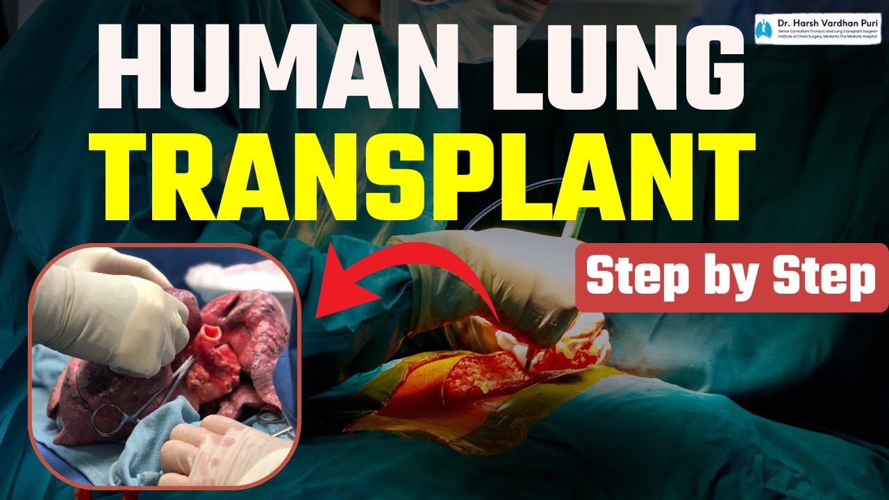 How Does Lung Transplant Work? | Human Lungs Transplant Process in Hindi | Dr. Harsh Vardhan Puri