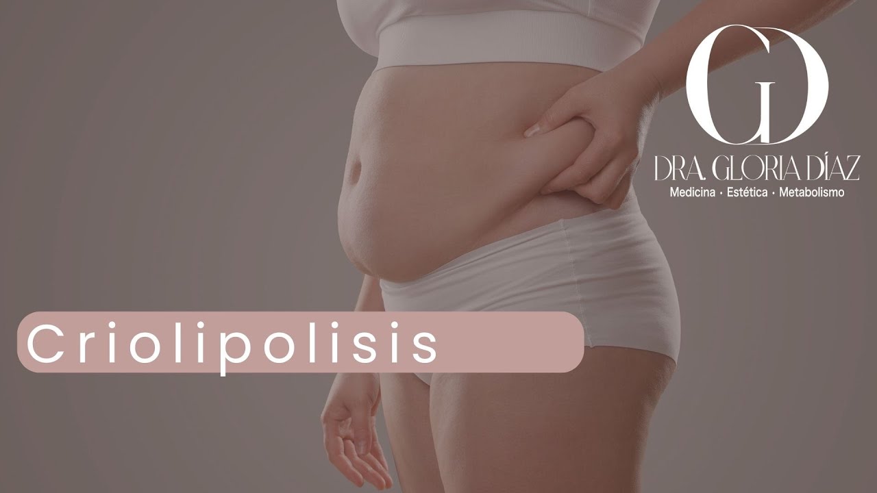 ¿Qué es la criolipólisis y cómo funciona?