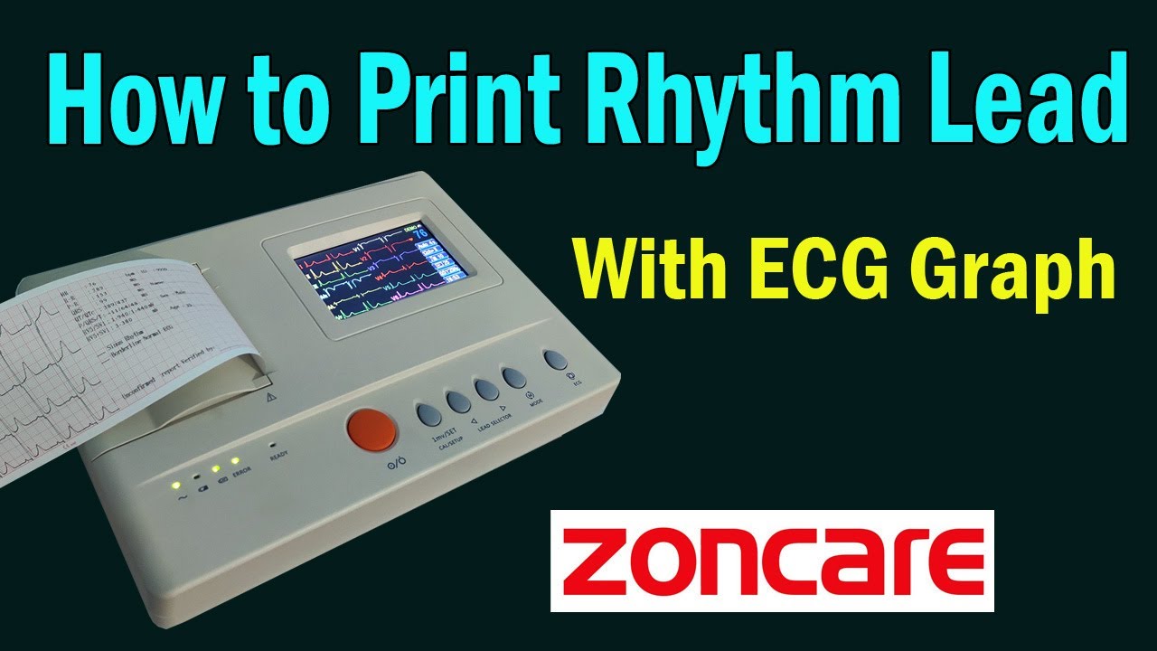 How to print ECG graph with Rhythm Lead. Zoncare ZQ-1203G. Time Medical 360