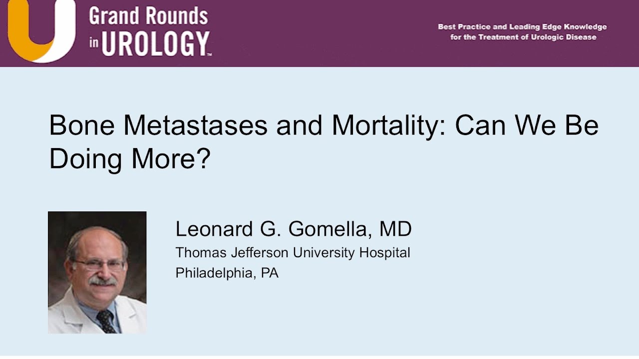 Bone Metastases and Mortality: Can We Be Doing More?