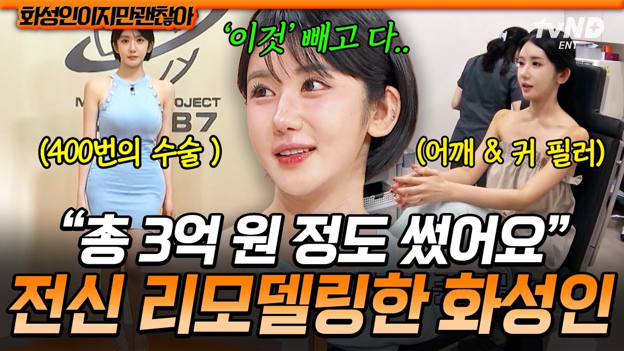 [#화성인이지만괜찮아] 성형·시술 종합 400회 이상💥 말문이 턱 막히는 화성인의 변천사⚡