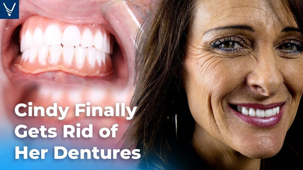 Cindy Finally Gets Rid of Her Dentures. (After Dental Implant Surgery)