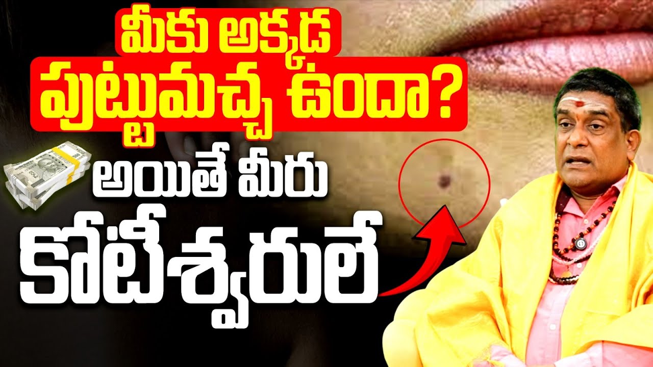 మీకు అక్కడ పుట్టుమచ్చ ఉందా? అయితే మీరు కోటీశ్వరులే Lucky Moles on Body for Wealth