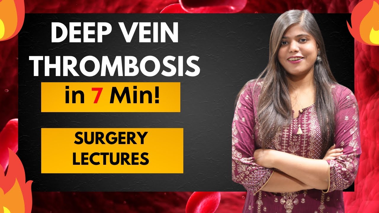 DVT- Definition, Clinical features, Treatment | Surgery Lectures and Notes