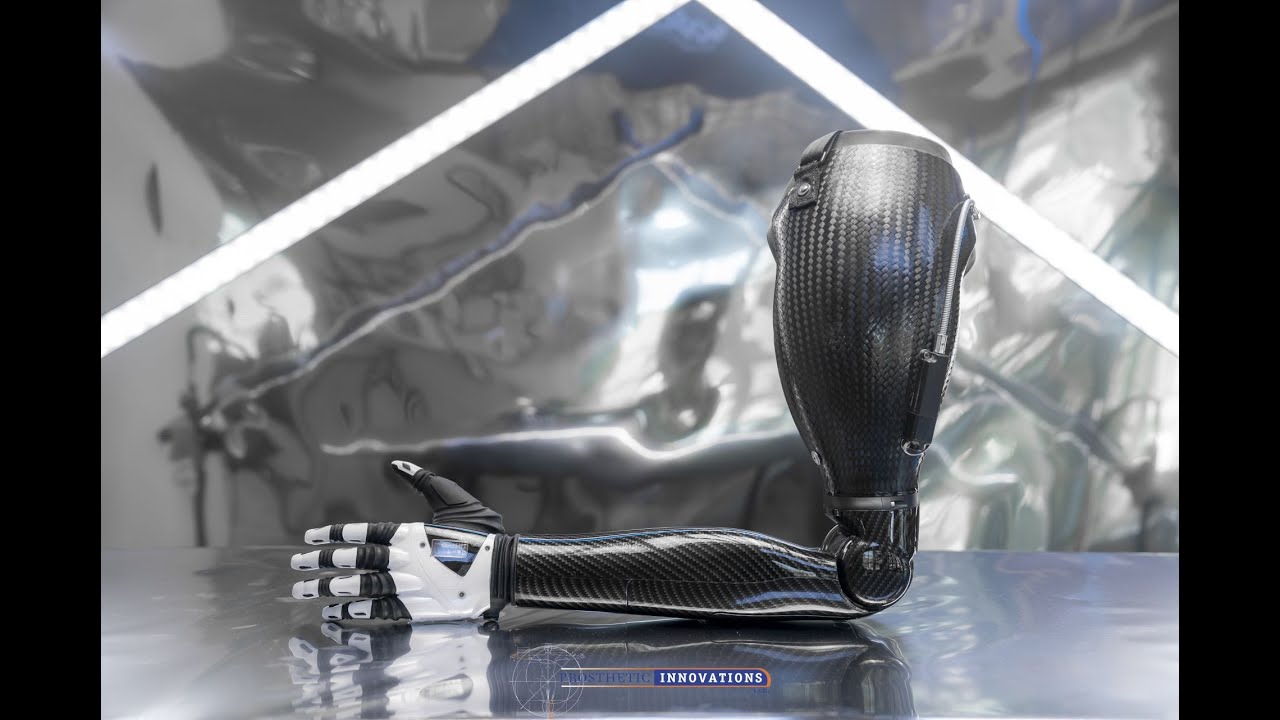 Trans-Humeral Myo-Electric Prosthesis | Prosthetic Innovations