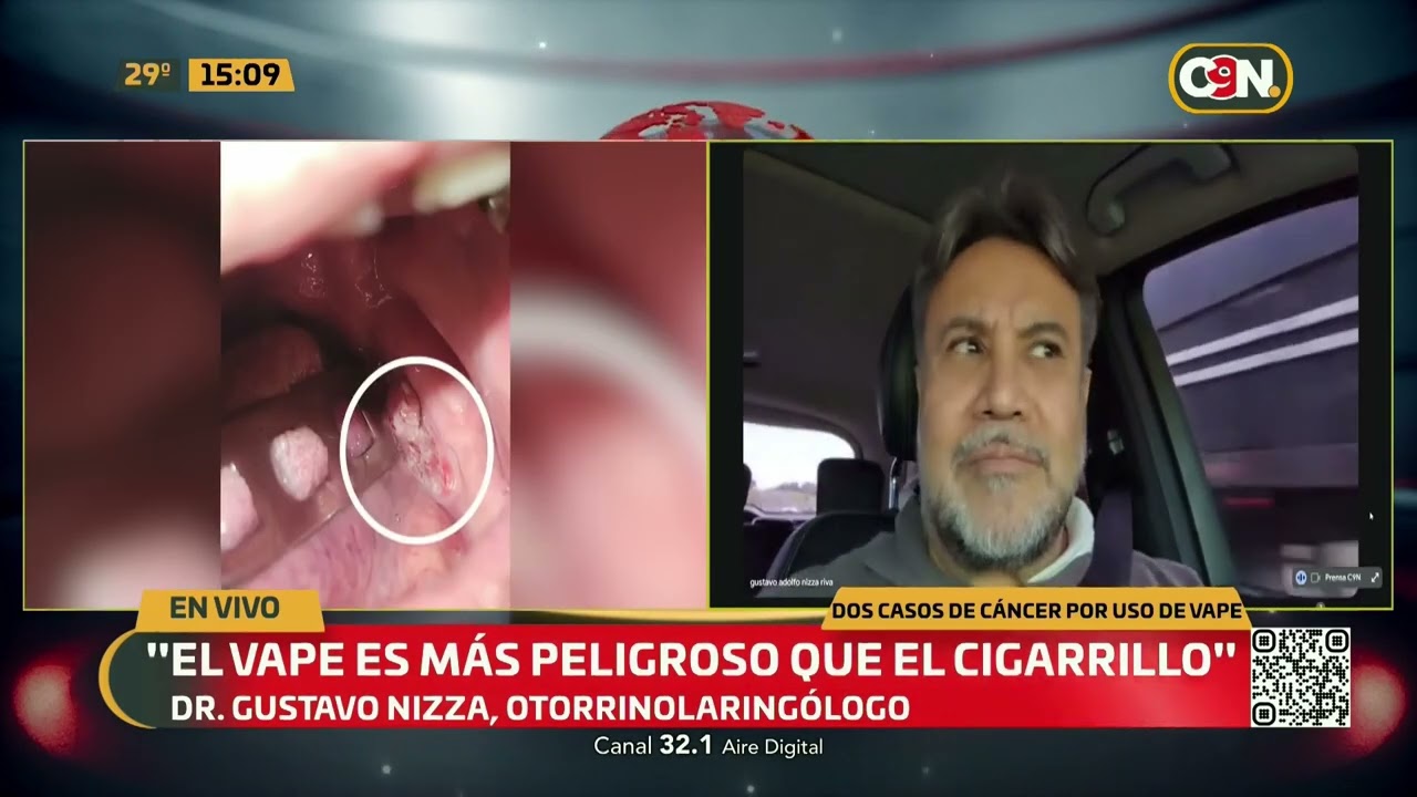 Alerta: Dos casos de c&aacute;ncer de am&iacute;gdalas por uso de vape