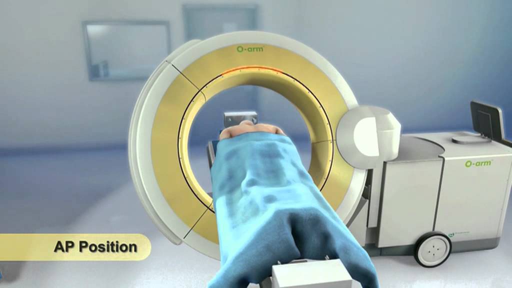O arm animation