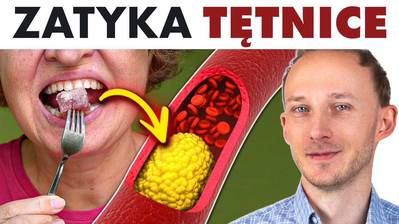 5 prawdziwych przyczyn zwężenia TĘTNIC i MIAŻDŻYCY