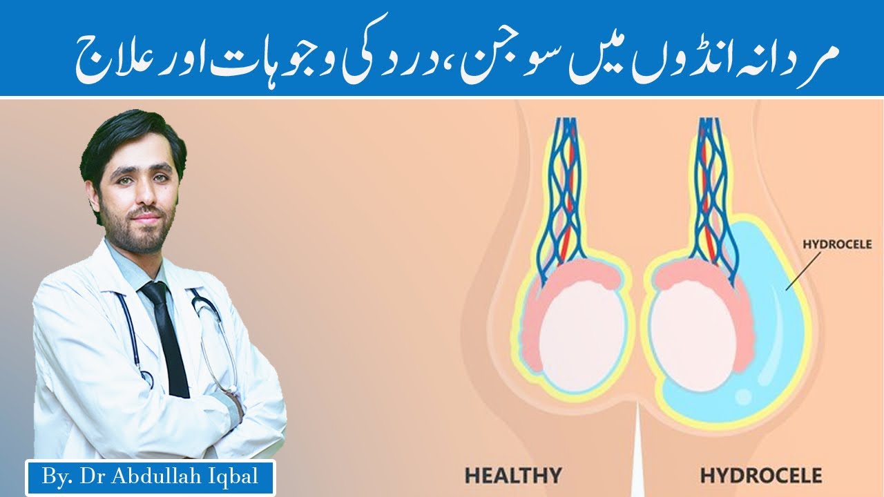 Testicular Pain and Testis Swelling | Hydrocele Causes, Symptoms & Treatment | Foton me dard, sojan