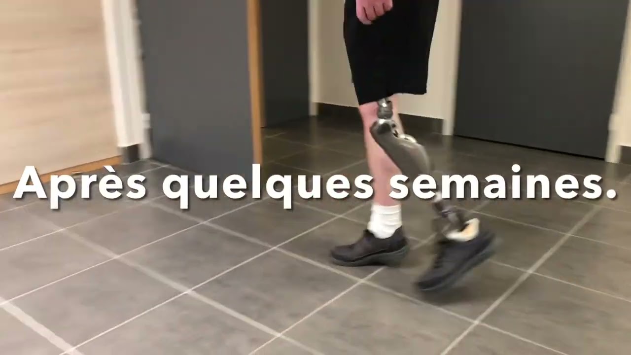 Mise en place d’un système Helix3D sur selle canadienne