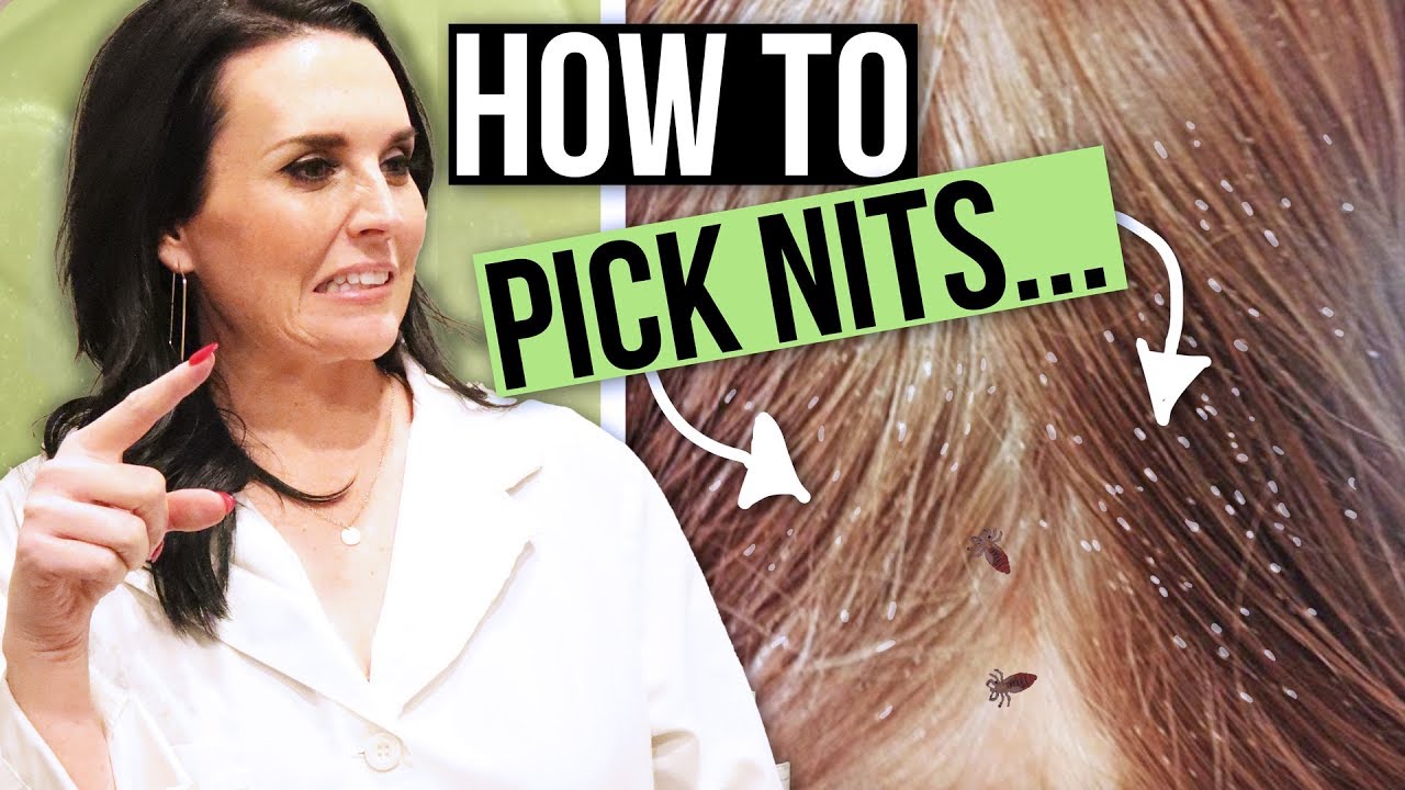 How to Remove Head Lice Eggs - Nit and Lice Picking