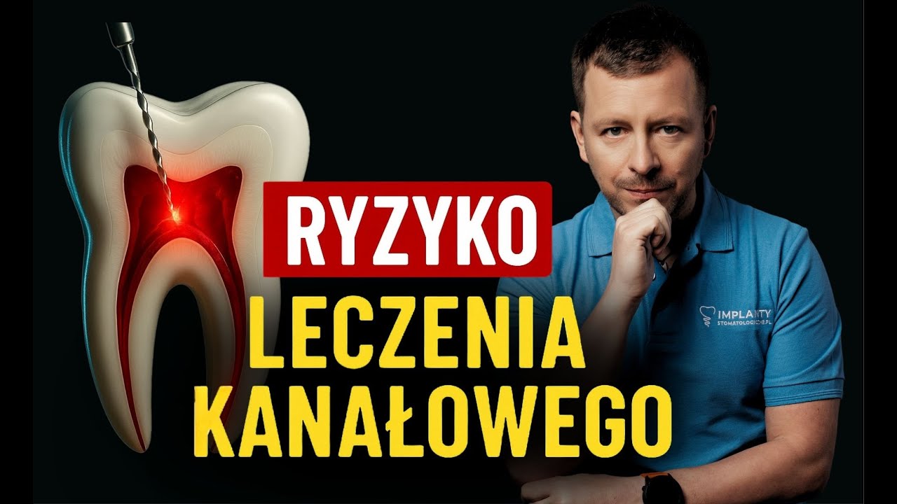 Ciemna strona leczenia kanałowego: fakty, kt&oacute;re Cię zaskoczą