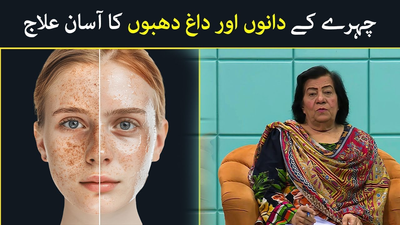 Acne Triggers | How To Treat Acne Scars | Causes of Acne | Acne Treatment | Hashmat Bibi
