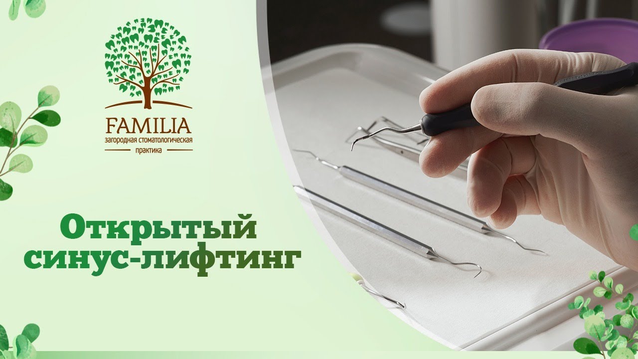 👉 Открытый синус-лифтинг