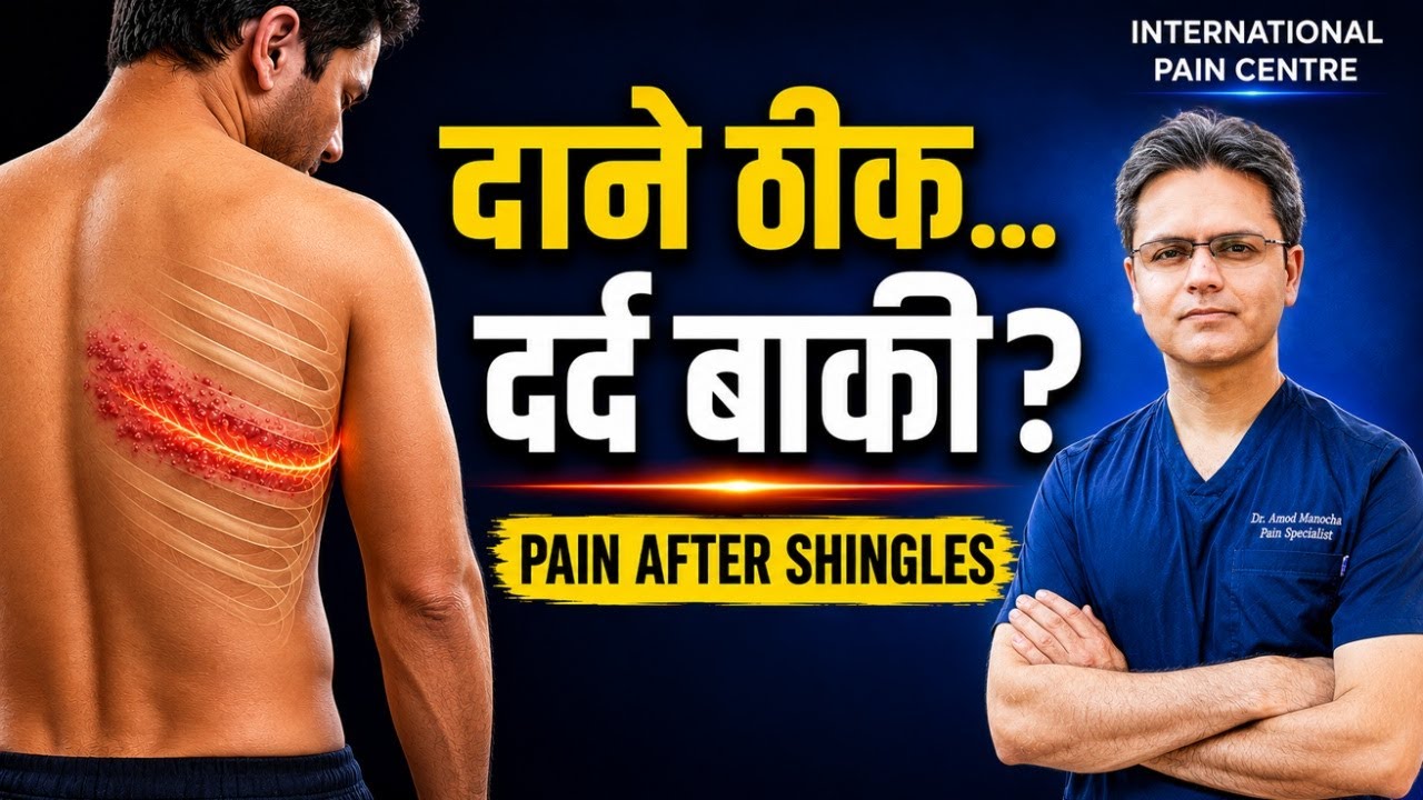 PHN (Post-Herpetic Neuralgia) – हर्पीस जॉस्टर के बाद दर्द बनी रहने का कारण & समाधान