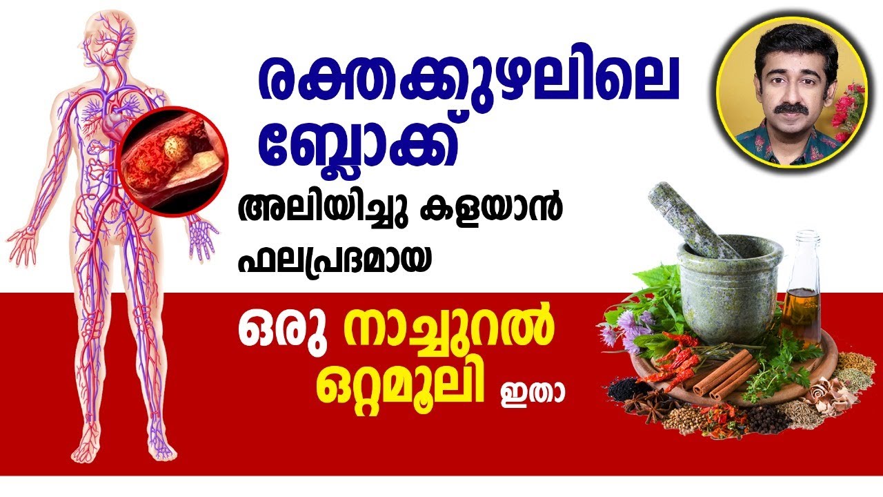 രക്തക്കുഴലിലെ ബ്ലോക്ക് അലിയിച്ചു കളയാൻ ഫലപ്രദമായ ഒരു നാച്ചുറൽ ഒറ്റമൂലി ഇതാ..Stroke Treatment