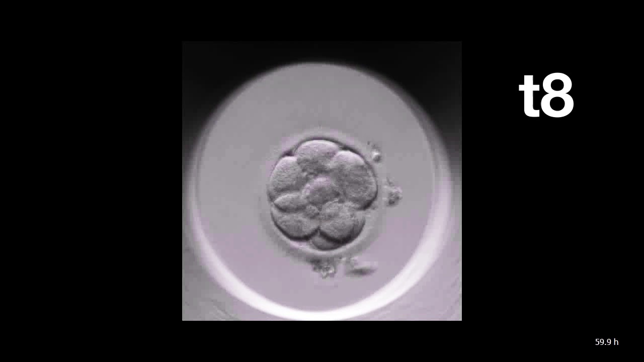 MIRI® TL | Time-Lapse Annotation of an Embryo | Esco Medical