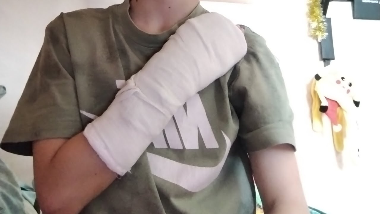 Я сломал себе руку 🤯