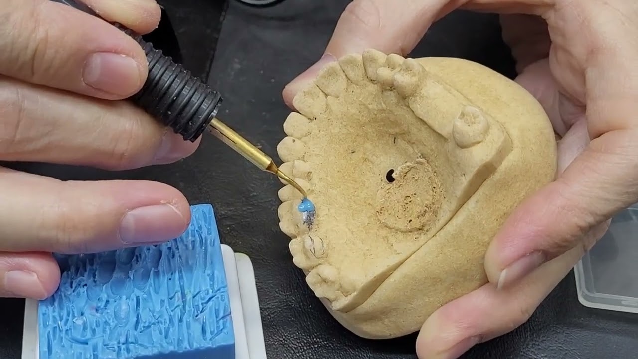 Enceramento de PPR - Prof. Fábio Tunes