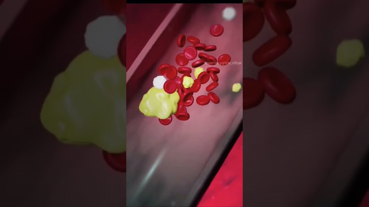 Simula&ccedil;&atilde;o Online de ataque card&iacute;aco - Anima&ccedil;&atilde;o 3D