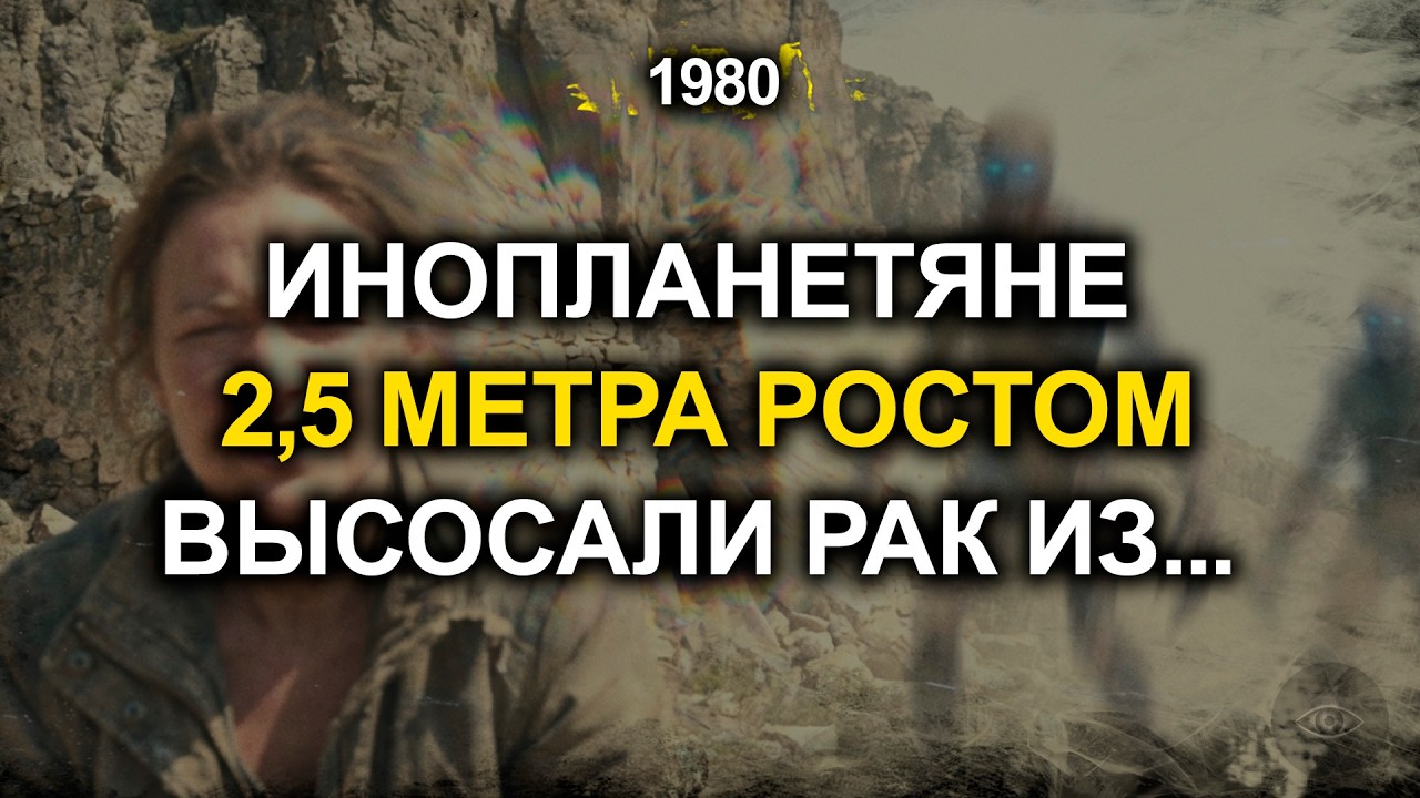 ИНОПЛАНЕТЯНЕ 2,5 Метра Ростом ВЫСОСАЛИ РАК ИЗ МОЕГО ТЕЛА ЧЕРЕЗ КАМЕНЬ... Врачи в ШОКЕ