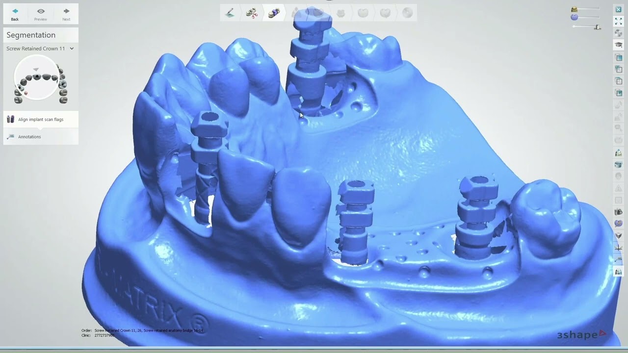 3Shape matrix&reg; Design | matrix&reg; Digital Academy