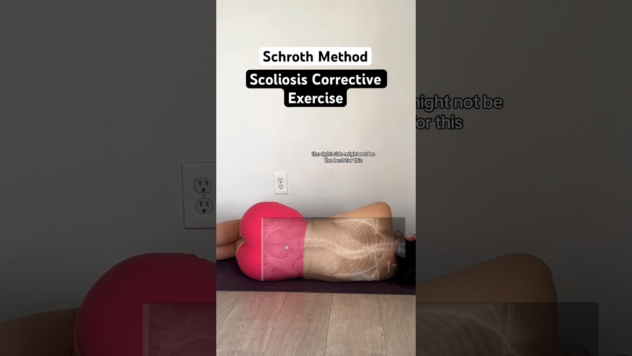 Корректирующие упражнения для сколиоза по методу Шрота #лечениесколиоза