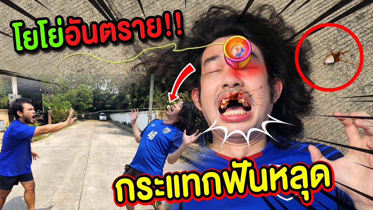 โยโย่อันตราย‼️ ลูกดิ่งกระแทกปากฟันร่วง🦷