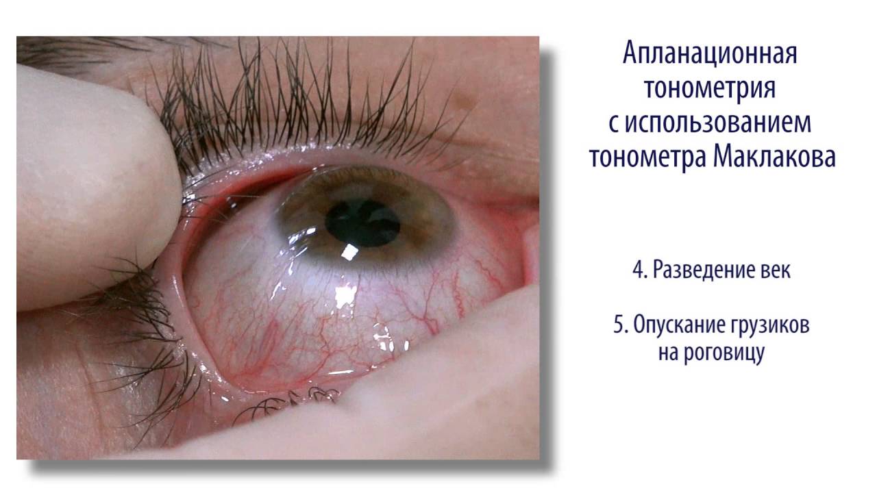 Тонометрия тонометром Маклакова (проект «Электронный учебник»)