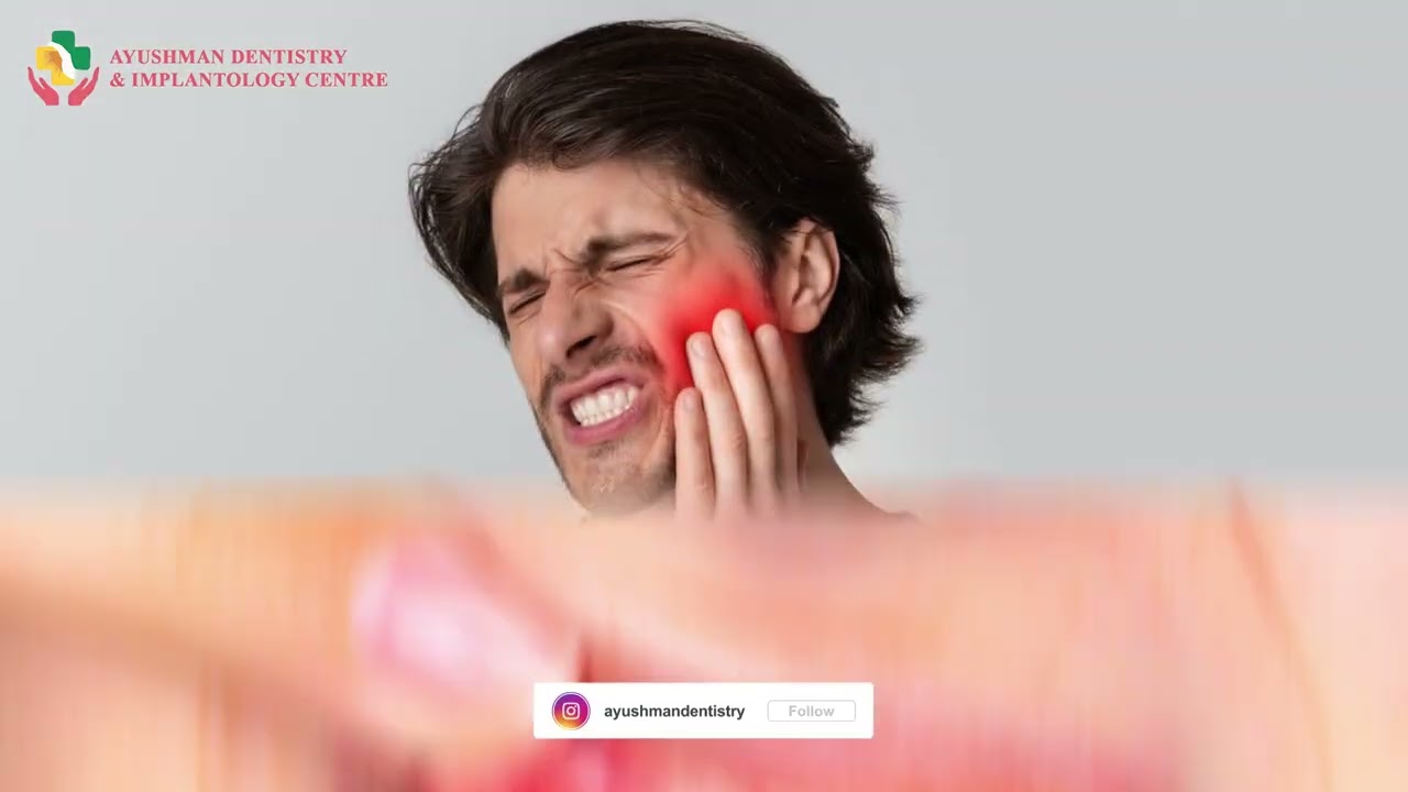 Swelling in Gums: Causes, Treatment & Healthy Smile Tips | Best dental clinic in Dwarka Delhi