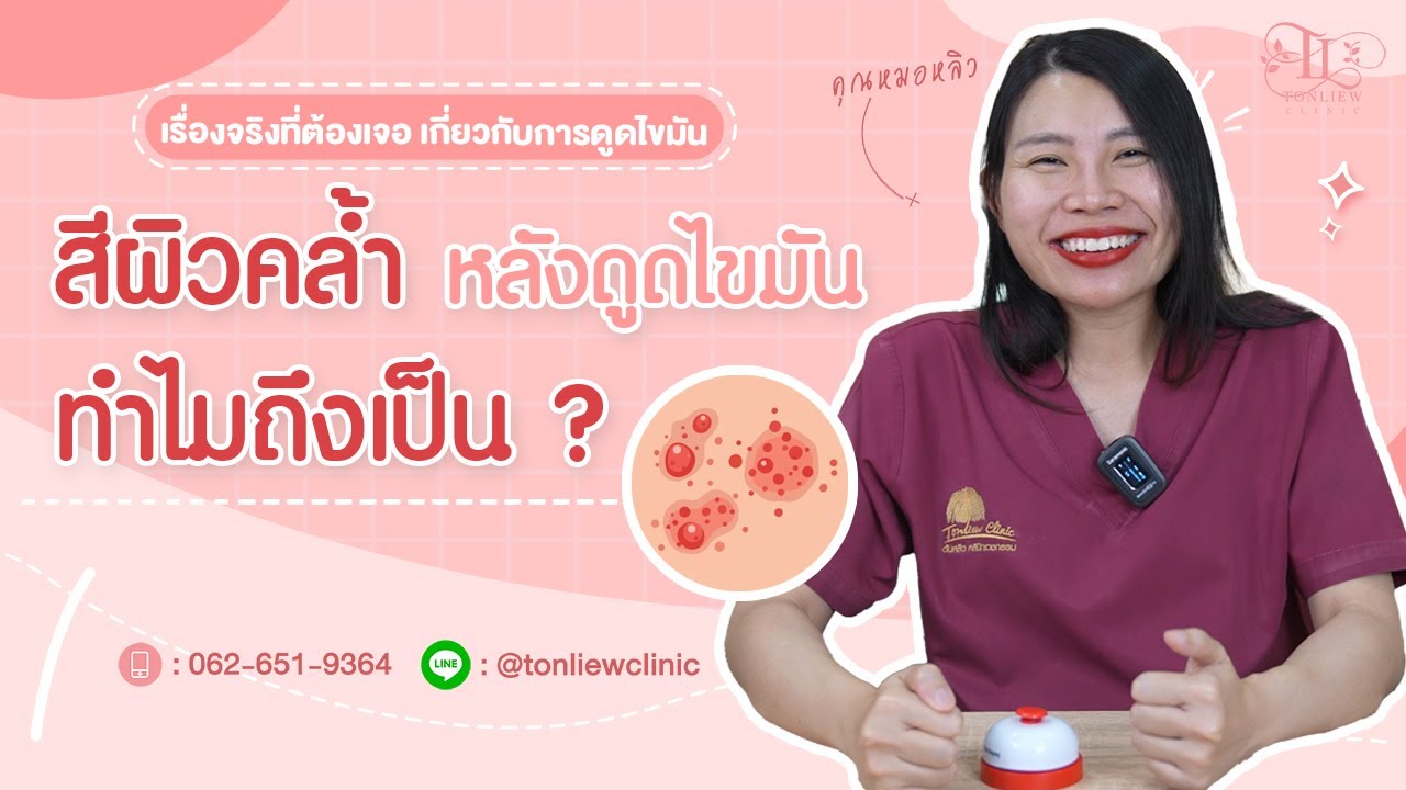 สีผิวที่คล้ำหลังดูดไขมัน เกิดจากอะไร ทำไมถึงเป็น ? แล้วทำยังไงให้กลับมา