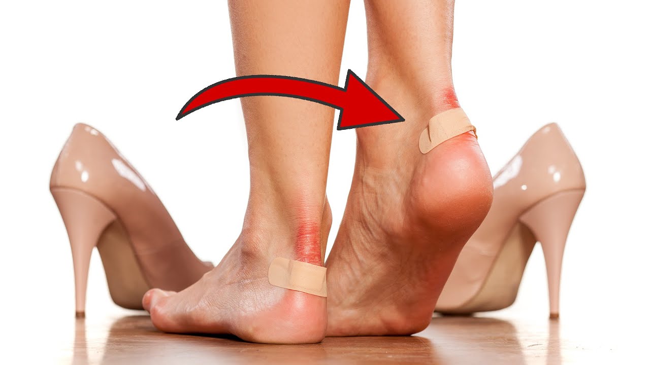 Blasen an den Füßen – DIE 5 besten Hausmittel 👣