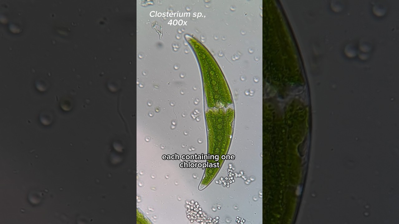 Jolly Green crescents under the microscope | Closterium sp.