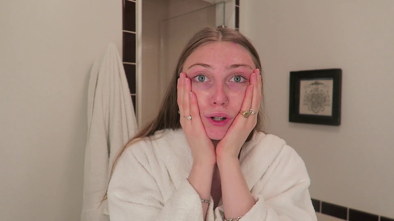 Morning Skincare Routine for Acne Prone Skin