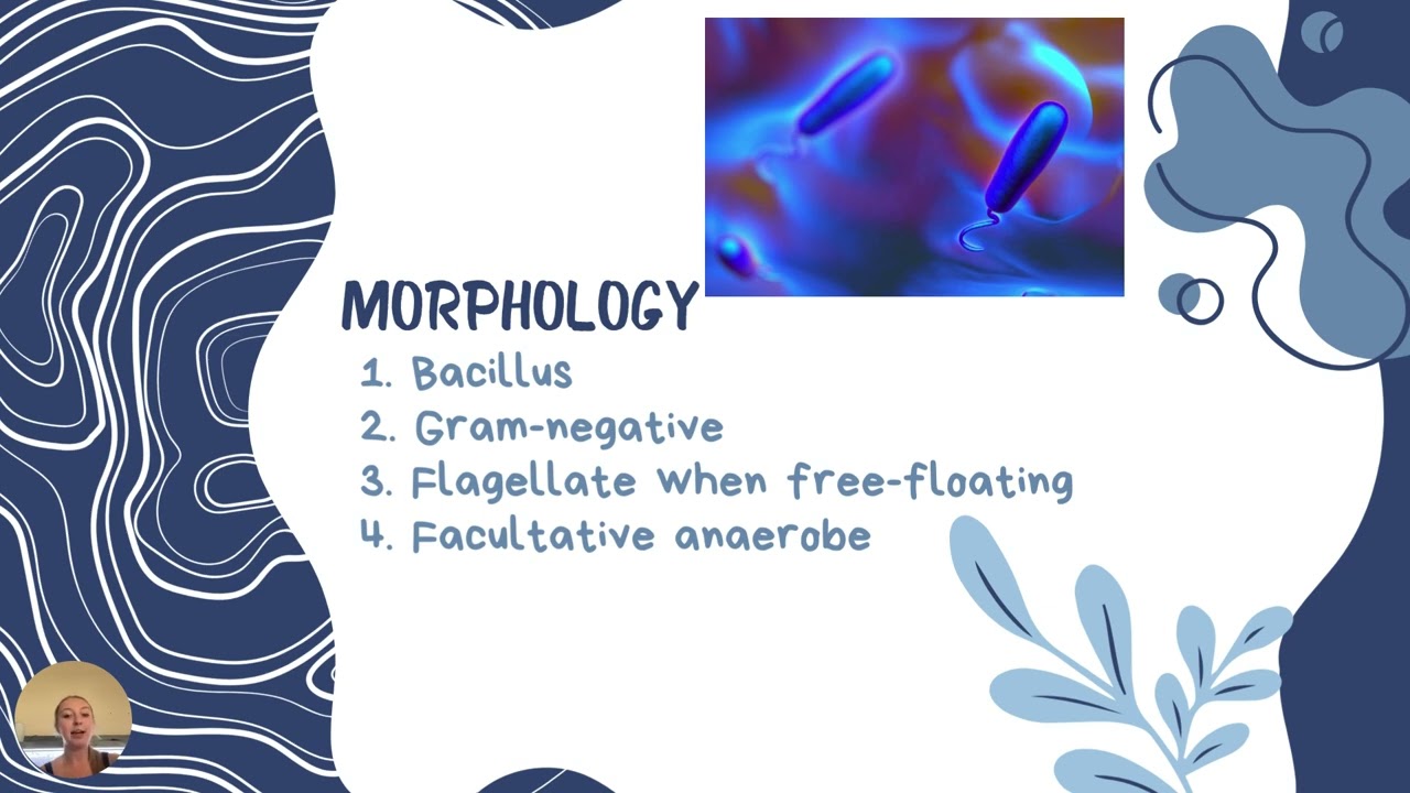 Tell it to your Mother about a microbe: Aliivibrio fischeri