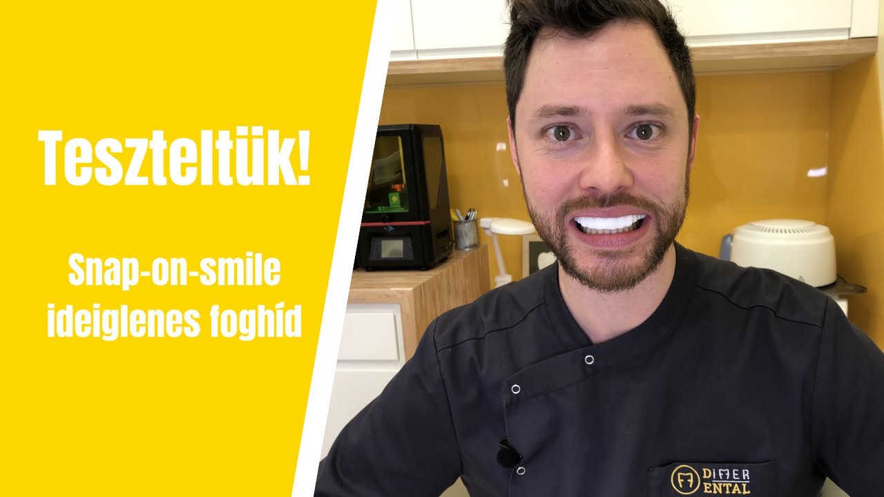 Teszteltük! Snap-on-smile ideiglenes foghíd