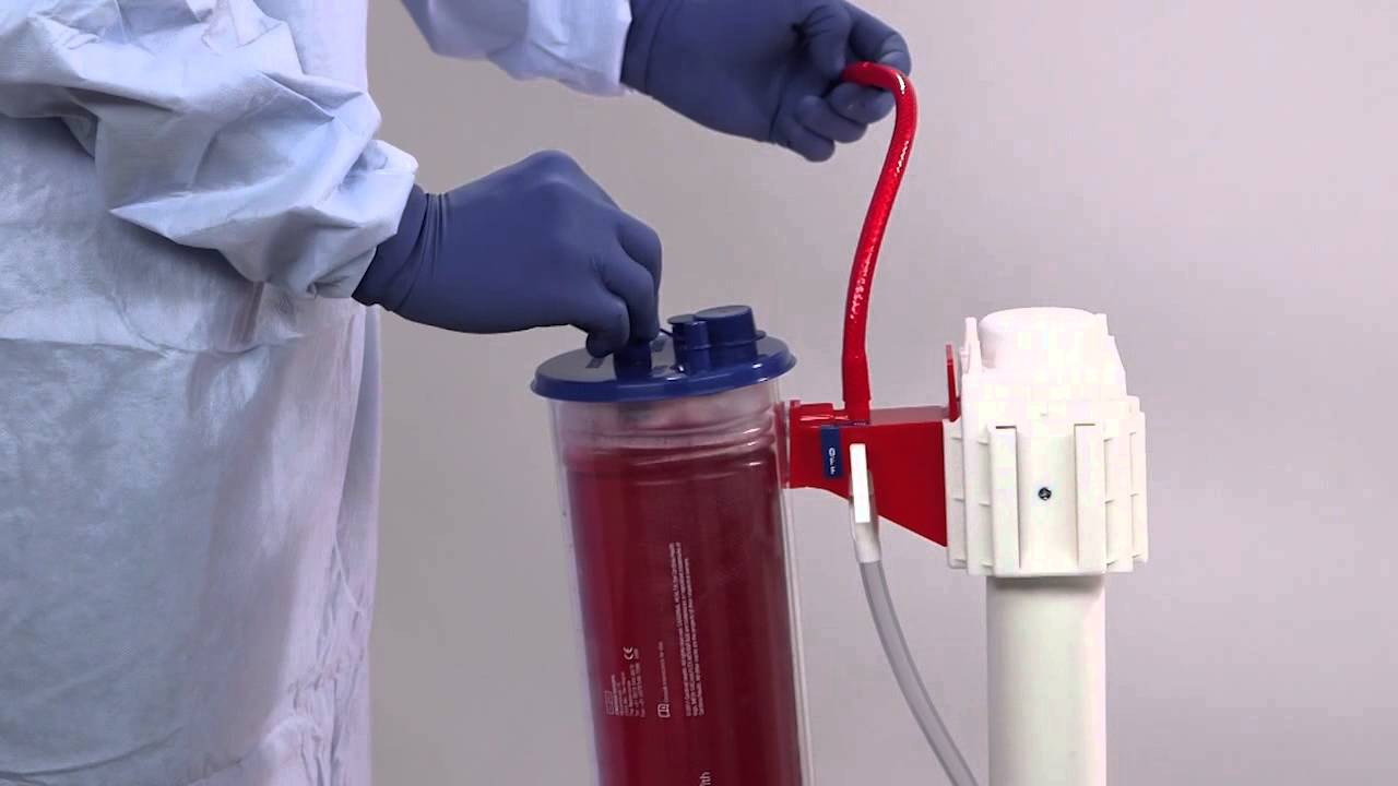 Medi-Vac® Flexible Liner System: Setup & Shutdown - Cardinal Health